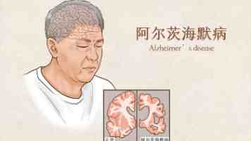 纲手大雷究竟指什么 - 火影梗百科与角色设计解析